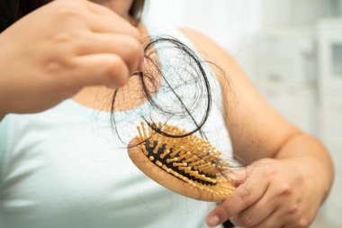 Asyalı kadınların tarak fırçasına eklenen uzun saç kaybıyla ilgili sorunları var..