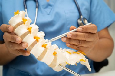 Omurga ve kemik modeli taşıyan Asyalı doktor, ortopedi bölümünde tedavi için bel kemiği yerinden oynamış disk parçası..