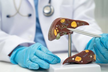 Dünya Hepatit Günü 'nde siroz, karaciğer kanseri, yağlı karaciğer, karaciğer anatomisi olan Asyalı doktor..