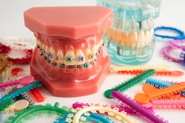 Ortodontik bağlar halkalar ve kravatlar, diş hekimliği üzerine çalışan dişçi için model..