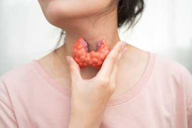 Hipertiroidizm, aşırı aktif tiroid, tiroid lenfoma, tiroid bezi insan anatomisi olan Asyalı kadın..