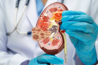 Kronik böbrek hastalığı, idrar sistemi, üroloji, tahmini küresel filtreleme oranı eGFR.