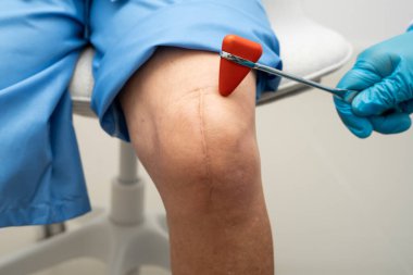 Asyalı doktor, hastanedeki yaşlı hastayı muayene etmek için diz refleksi sinirine vurdu..