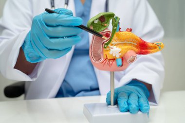 Pankreas iltihabı, pankreas hastası Asyalı doktor, safra kesesi ve safra kesesi insan anatomisi modeli..