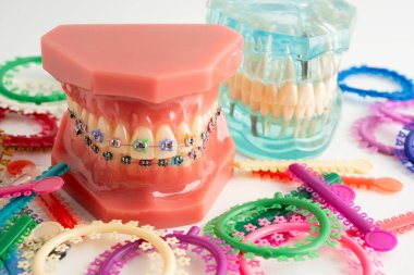 Ortodontik bağlar halkalar ve kravatlar, diş hekimliği üzerine çalışan dişçi için model..