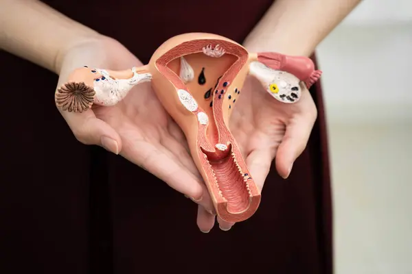 Rahim, Asyalı, kadın insan anatomisi modeli tutuyor..