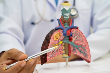 Zatürree, akciğer kanseri, Asyalı doktor hastanede teşhis ve tedavi için insan anatomisi modeli tutuyor.