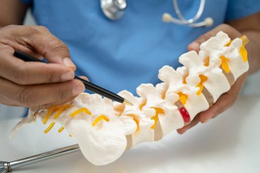 Omurga ve kemik modeli taşıyan Asyalı doktor, ortopedi bölümünde tedavi için bel kemiği yerinden oynamış disk parçası..