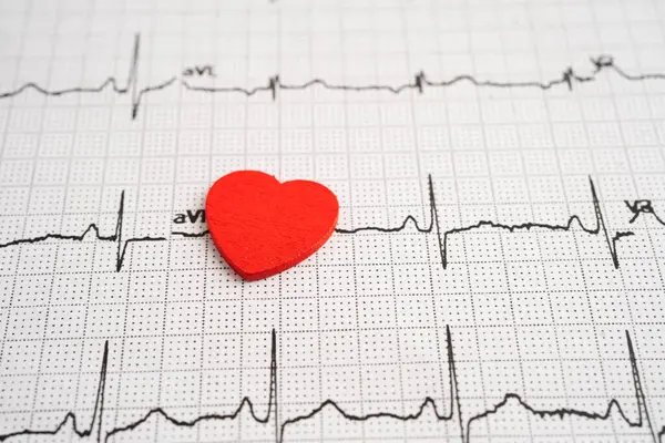 Elektrokardiyogram EKG kalp dalgası, kalp krizi, kardiyogram raporu.