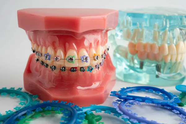 Ortodontik bağlar halkalar ve kravatlar, diş hekimliği üzerine çalışan dişçi için model..