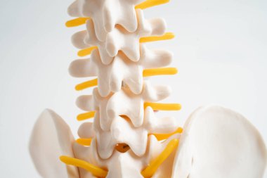 Omurga ve kemik, bel kemiği yerinden oynamış disk parçası, ortopedi bölümünde tedavi için model..