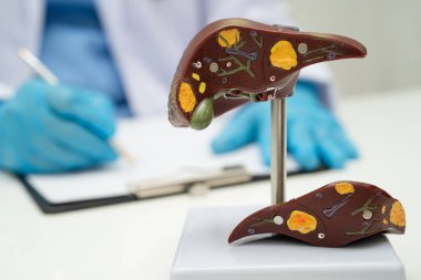 Dünya Hepatit Günü 'nde siroz, karaciğer kanseri, yağlı karaciğer, karaciğer anatomisi olan Asyalı doktor..