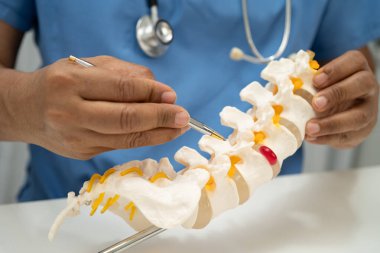 Omurga ve kemik modeli taşıyan Asyalı doktor, ortopedi bölümünde tedavi için bel kemiği yerinden oynamış disk parçası..