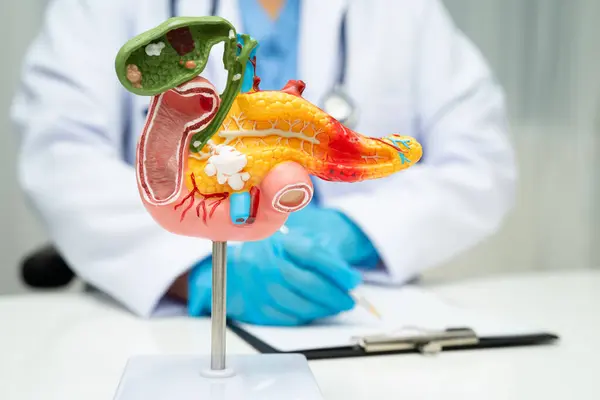 Pankreas iltihabı, pankreas hastası Asyalı doktor, safra kesesi ve safra kesesi insan anatomisi modeli..