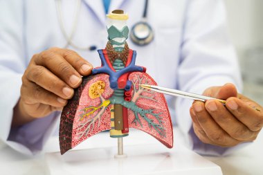 Zatürree, akciğer kanseri, Asyalı doktor hastanede teşhis ve tedavi için insan anatomisi modeli tutuyor.