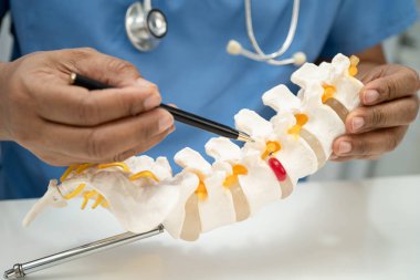 Omurga ve kemik modeli taşıyan Asyalı doktor, ortopedi bölümünde tedavi için bel kemiği yerinden oynamış disk parçası..
