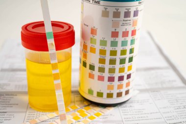 İdrar tahlili, reaksiyonlu idrar kabı. PH kağıt testi ve karşılaştırma tablosu laboratuvarda..