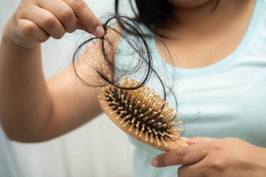 Asyalı kadınların tarak fırçasına eklenen uzun saç kaybıyla ilgili sorunları var..