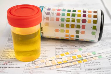 İdrar tahlili, reaksiyonlu idrar kabı. PH kağıt testi ve karşılaştırma tablosu laboratuvarda..