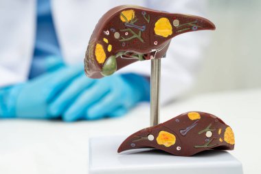 Dünya Hepatit Günü 'nde siroz, karaciğer kanseri, yağlı karaciğer, karaciğer anatomisi olan Asyalı doktor..
