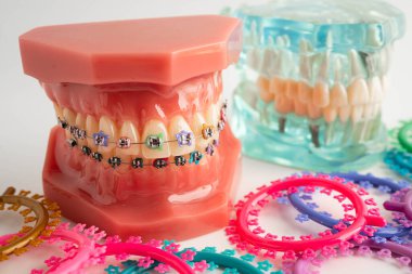 Ortodontik bağlar halkalar ve kravatlar, diş hekimliği üzerine çalışan dişçi için model..