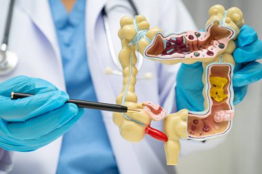 Bağırsak, hastanede teşhis ve tedavi için insan anatomisi modeli tutan doktor..