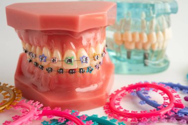 Ortodontik bağlar halkalar ve kravatlar, diş hekimliği üzerine çalışan dişçi için model..