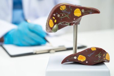 Dünya Hepatit Günü 'nde siroz, karaciğer kanseri, yağlı karaciğer, karaciğer anatomisi olan Asyalı doktor..