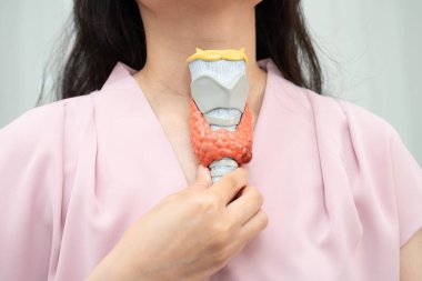 Hipertiroidizm, aşırı aktif tiroid, tiroid lenfoma, tiroid bezi insan anatomisi olan Asyalı kadın..