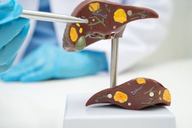 Dünya Hepatit Günü 'nde siroz, karaciğer kanseri, yağlı karaciğer, karaciğer anatomisi olan Asyalı doktor..