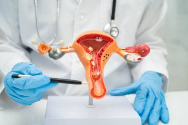 Rahim, hastanede teşhis ve tedavi için insan anatomisi modeli tutan doktor..
