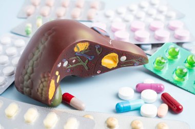 Hap tedavisi gören karaciğer modeli, siroz, karaciğer kanseri, yağlı karaciğer..