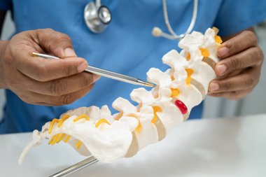 Omurga ve kemik modeli taşıyan Asyalı doktor, ortopedi bölümünde tedavi için bel kemiği yerinden oynamış disk parçası..