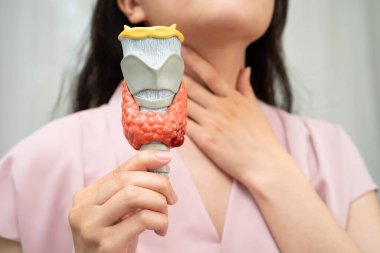 Hipertiroidizm, aşırı aktif tiroid, tiroid lenfoma, tiroid bezi insan anatomisi olan Asyalı kadın..