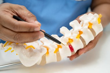Omurga ve kemik modeli taşıyan Asyalı doktor, ortopedi bölümünde tedavi için bel kemiği yerinden oynamış disk parçası..