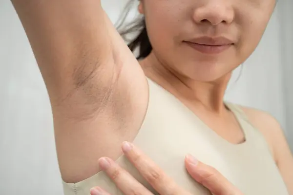 Asyalı kadınların siyah koltuk altı güzellik sorunları vardır..