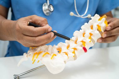 Omurga ve kemik modeli taşıyan Asyalı doktor, ortopedi bölümünde tedavi için bel kemiği yerinden oynamış disk parçası..