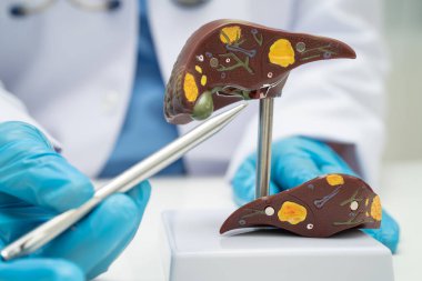 Dünya Hepatit Günü 'nde siroz, karaciğer kanseri, yağlı karaciğer, karaciğer anatomisi olan Asyalı doktor..