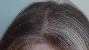 Belirgin gri iplikçiklere sahip genç bir kadının tacı: iki eli de saçına batar. Stres, iç gerilim ve değişimin kabulünü simgeleyen duygusal bir an..