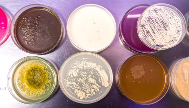 Paslanmaz çelik bir yüzeye yerleştirilmiş birden fazla petri kabının yüksek çözünürlüklü yakın çekimi, her tabağın içinde deneysel veya sanatsal reaksiyonlar sonucu canlı renk patlamaları içeriyor..