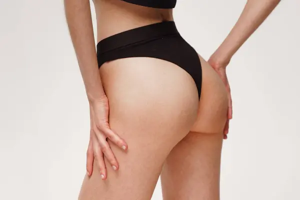 Woman Beautiful Feminine Figure Black Lingerie Overweight Cellulite Stretch Marks — Stock Photo, Image