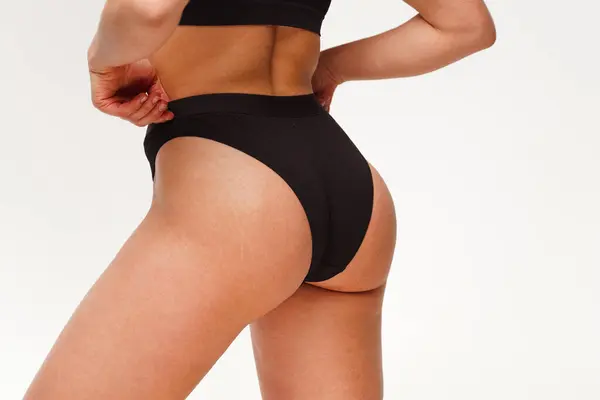 Woman Beautiful Feminine Figure Black Lingerie Overweight Cellulite Stretch Marks — Stock Photo, Image