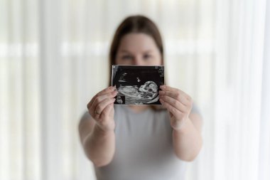 Z Gen hamile kadın elinde bir fetüsün ultrason fotoğrafını gösteriyor. Hamilelik kavramı, doğum öncesi bakım. Yüksek kalite fotoğraf