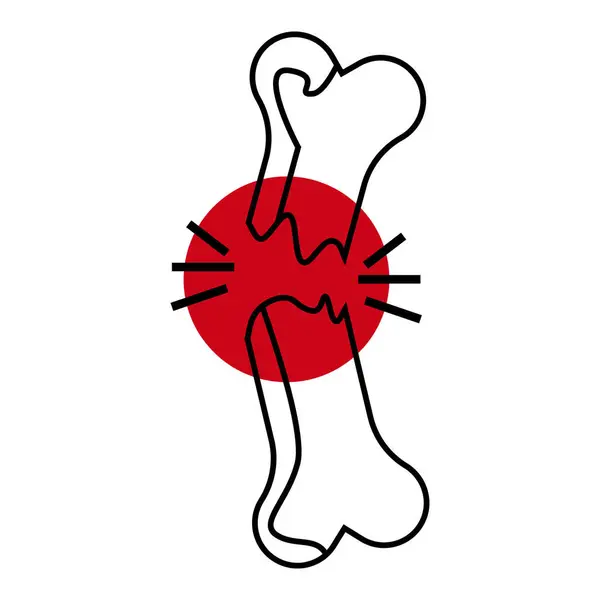 Bu diyagram olası kırık ve gözenekli kemik yapısına sahip hasarlı bir eklem tasvir ediyor. Bu da eklem ağrısı ve potansiyel yapısal dengesizliği gösteriyor..