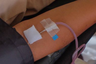 Kan donöründen kan alma işlemi. Eline kanlı mızrak saplanmış. İnsanlık için kan bağışı