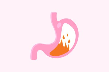 Mide ikonu seti, karikatür vektör çizimi. Normal ve anormal midenin kesiti. Beyaz arka planda izole edilmiş. 10 saniye.