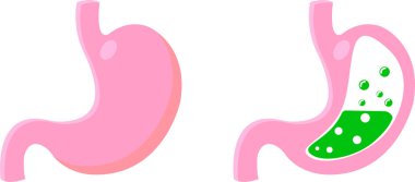 Mide ikonu seti, karikatür vektör çizimi. Normal ve anormal midenin kesiti. Beyaz arka planda izole edilmiş. 10 saniye.