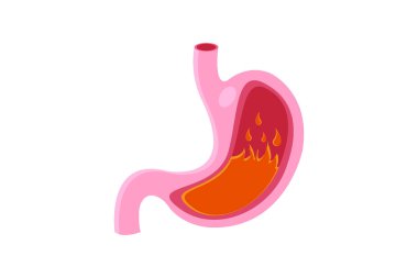 Mide ikonu seti, karikatür vektör çizimi. Normal ve anormal midenin kesiti. Beyaz arka planda izole edilmiş. 10 saniye.