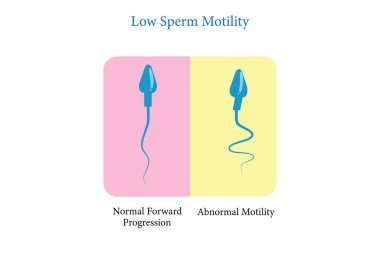 Sperm hareketi, düşük sperm sayısı, sperm analizi, vektör illüstrasyonu E10