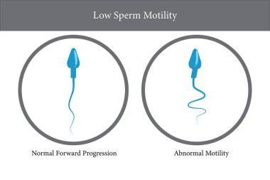 Sperm hareketi, düşük sperm sayısı, sperm analizi, vektör illüstrasyonu E10